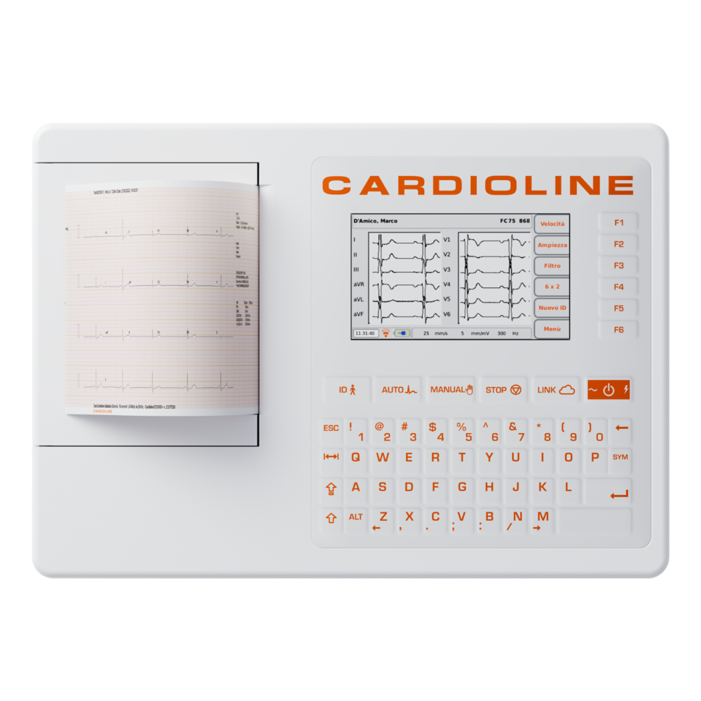 ECG100S_Ruhe-EKG_Cardioline ECG100S_Ruhe-EKG_Cardioline
